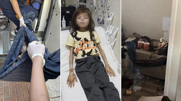 Çöp evde bulunan çocuğun sağlığı nasıl?