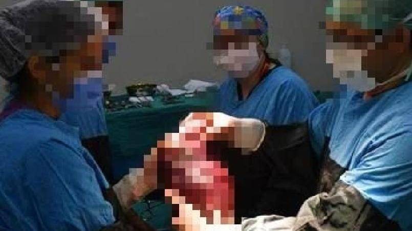 Çöpe atıldığı öğrenilmişti! Kargoda kaybolan dalak için hastaneye şaka gibi ceza: 3 bin lira ödeyecek