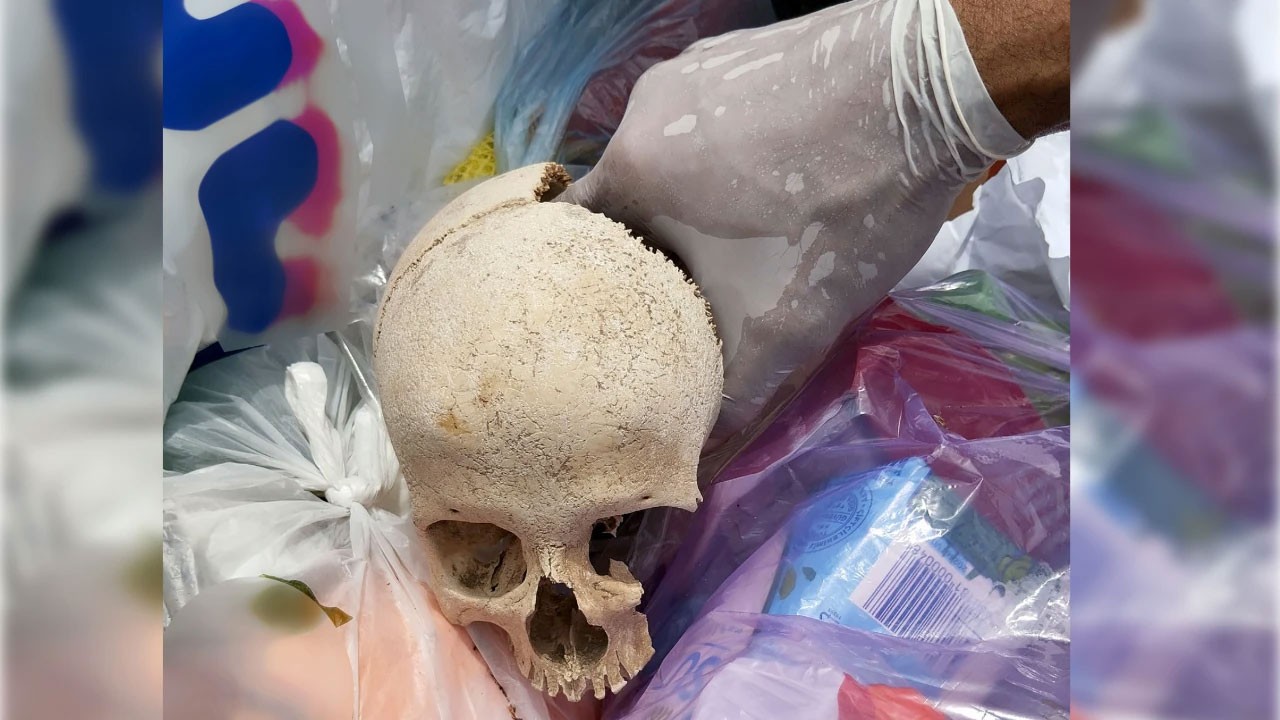 Çöpte bulunan kafatasının sırrı ortaya çıktı