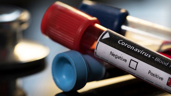 Corona virüs aşısı bulundu mu? Avigan nedir?