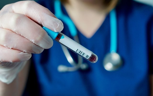 Corona virüs aşısı Türkiye'de mi yapılacak? Corona virüs tedavisi bulundu mu?