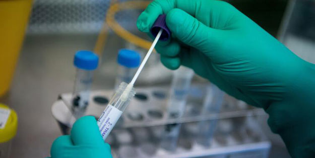 Corona virüs ile sars virüsü aynı mı?