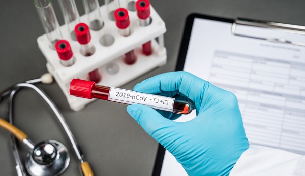 Corona virüsünden nasıl korunmak gerekiyor?