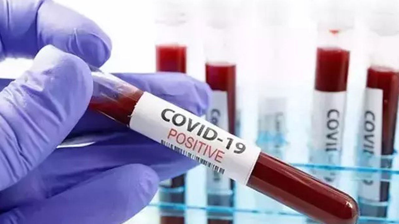 Covid-19 geri mi döndü? Haftada 300’den fazla can kaybı