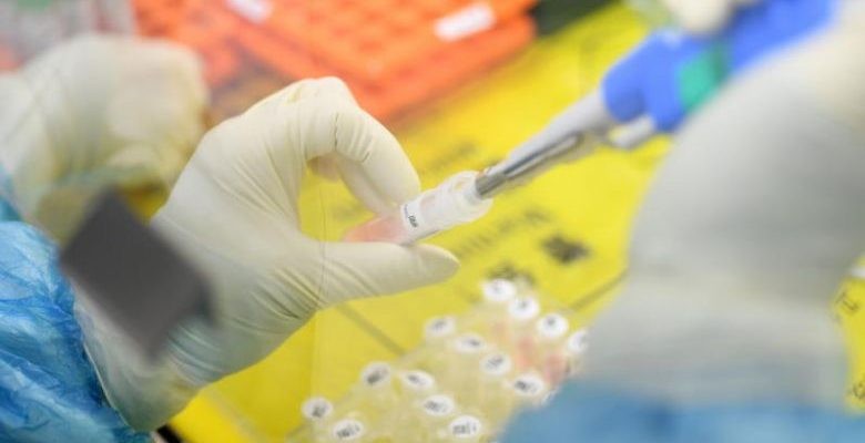 Covid-19 tanı laboratuvarı olan iller arasında Erzincan’da yer aldı 