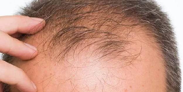 Covid geçirenlerin saçını çıkaran tarif uzmanından