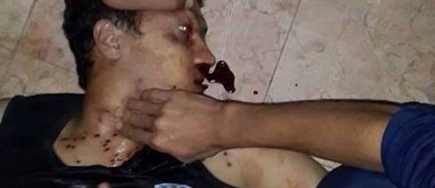 Cuntanın adamları Ezher’i bastı: 1 ölü, 320 yaralı