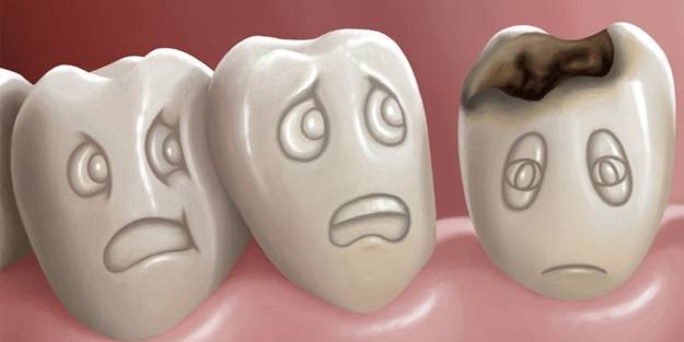 Çürük dişler ile fazla kilo alımı arasında nasıl bir ilişki var? Çürük diş zararları