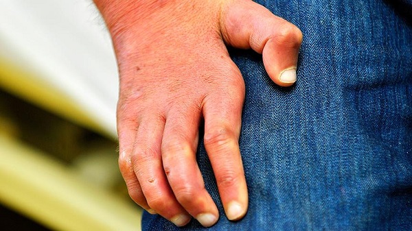 Cüzzam o ülkelerde halen tehlikeli