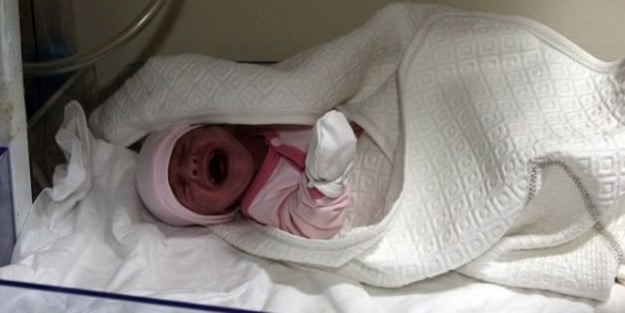 Daha 2 aylık ama tüm organları ters!