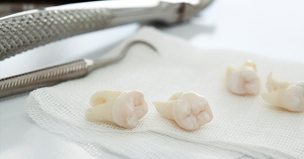 Daha beyaz görünsün diye sağlığınızdan olmayın! Bu yöntemler dişlerinizi kaybetmenize sebep olabilir