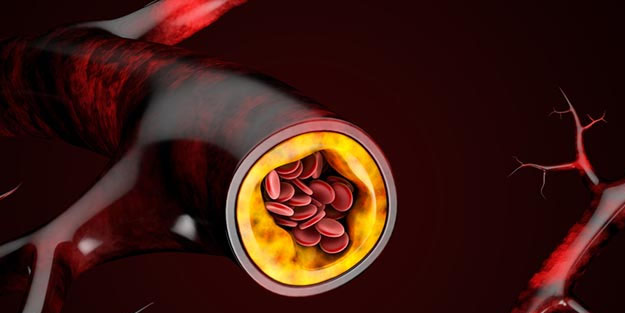 Damarlarınızı tertemiz yapacak sır tarif