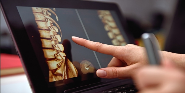 Dar kanal hastalığı nedir? Nasıl tedavi edilir?