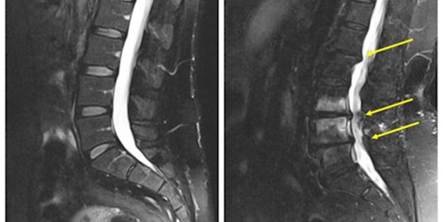 'Dar Kanal' hayatı zehir eder