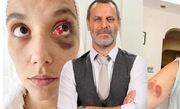 Dayakçı Ozan Güven’in dövdüğü iddia edilen kadın kameralara saldırdı!
