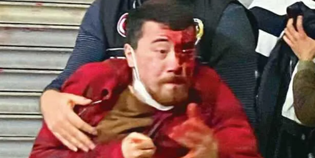 Dehşet anlarını anlattı: Polis bunlar öldürün...