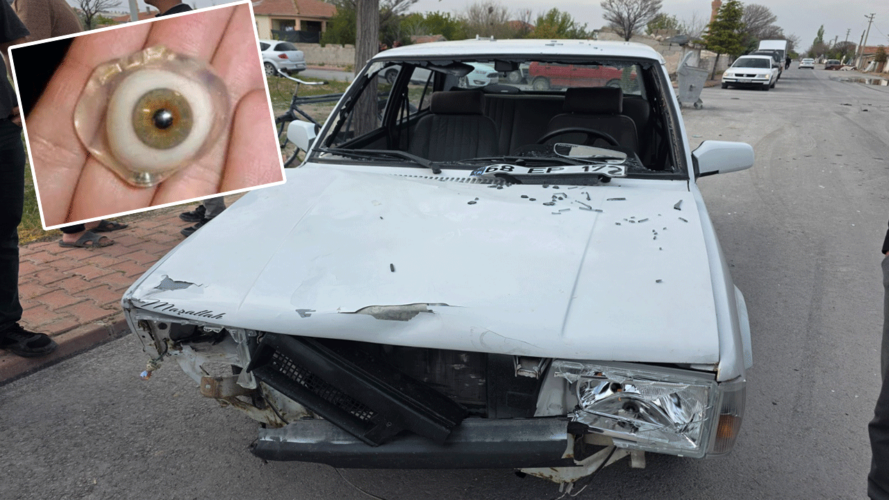 Dehşet: Otomobille çarpışan motosikletlinin gözü yerinden çıktı