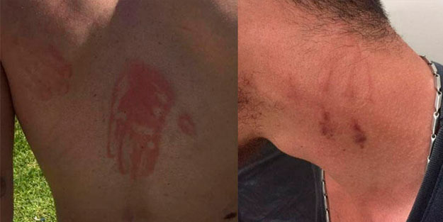 Dehşet veren olay! Döverek bu hale getirdiler