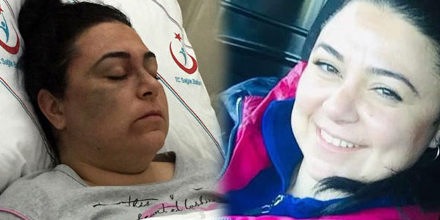 Dehşet veren olay! Tanımadığı 3 kadını döverek hastanelik etti