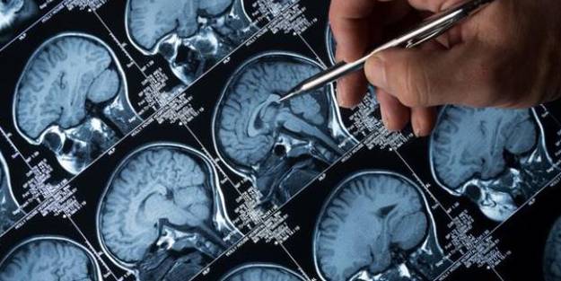 Dehşete düşüren olay! Burnundan giren parazit beynini yedi