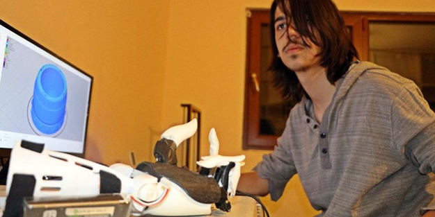 Deney yaparken elini kaybetmişti... Dönüşü muhteşem oldu!