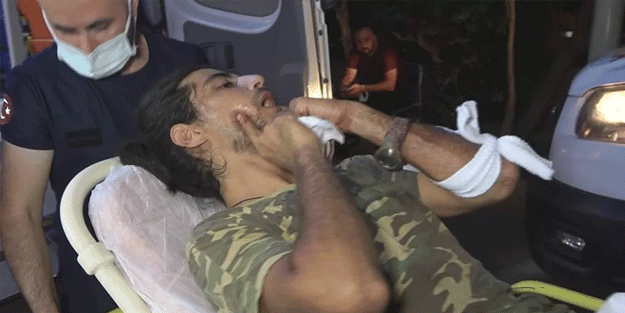 Denizi kirletenleri uyardı, falçatayla boğazlarından yaraladı!