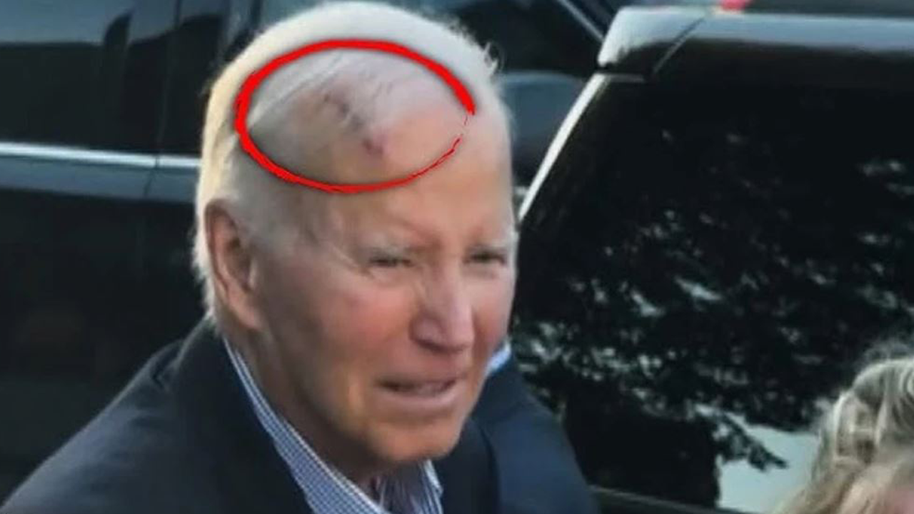 Densiz’in lakabı ‘Kanser Başkan’a döndü! Acil ameliyat edildi