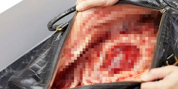 Deri çantanın içindeki organları görünce şok oldular