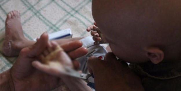 Derisini makasla kesmek zorundalar!