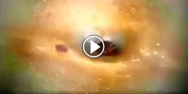 Devasa siyah nokta ameliyatı!