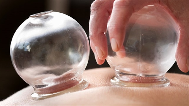 Devlet hastanelerinde hacamat tedavisi