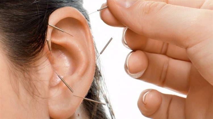 Devlet Hastanesinde akupunktur dönemi