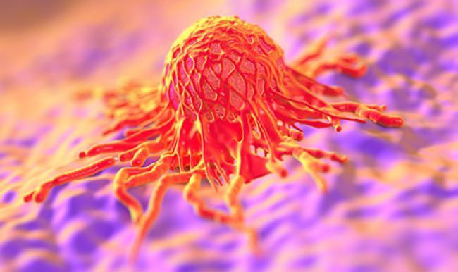 Devletten kanser hastalarına iyi haber!