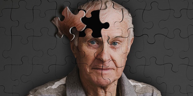 Dikkat bu belirti birçok kişide var! Alzheimer ilk nasıl başlıyor?