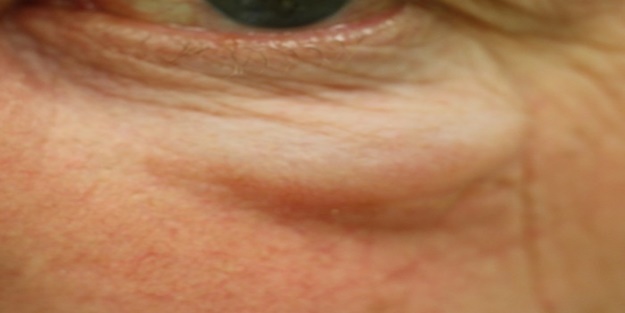 Dikkat! Bu besinler ödem yapıyor