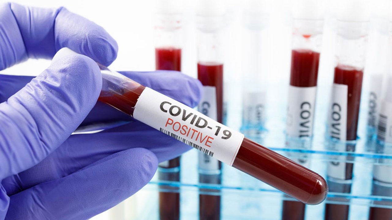 Dikkat çeken araştırma! Zayıf kişiler Kovid-19’u daha ağır geçiriyor