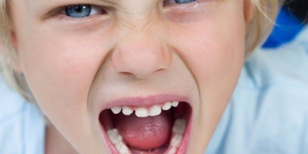 Dikkat! Çocuğunuz arkadaşlarını mı ısırıyor?