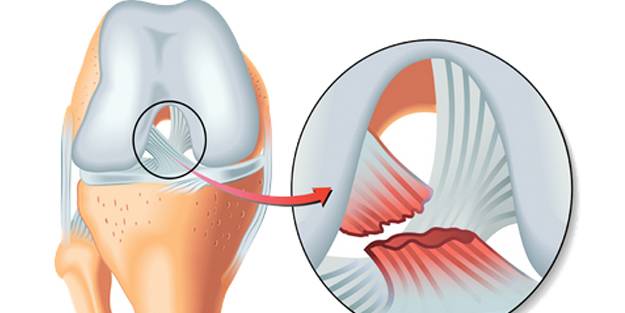 Dikkat! En çok spor esnasında meydana geliyor