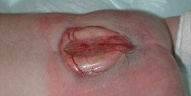 Dikkat! Gebelikten önce önlem alın