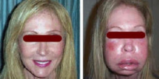 Dikkat! Öldürücü olabilir