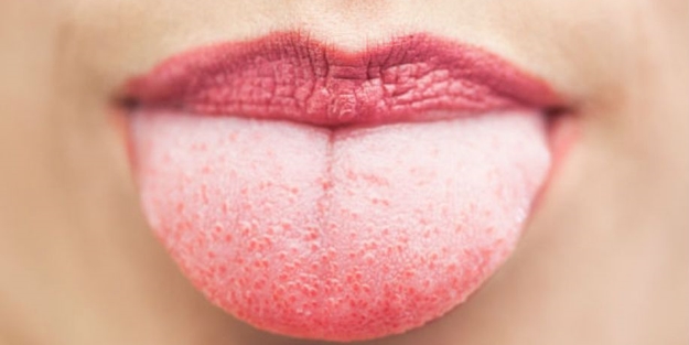 Dil kanseri bu belirtiler ile kendini belli ediyor!