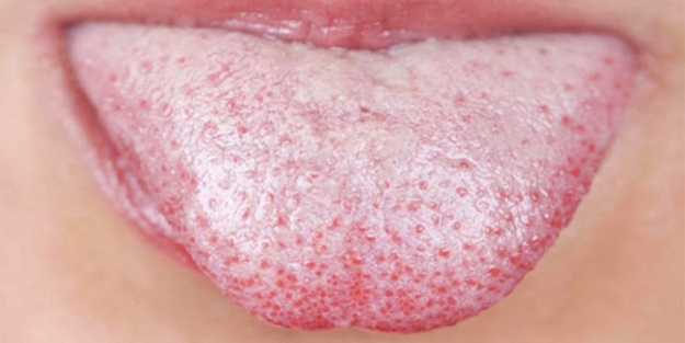 Dilinizde beyazlık varsa...