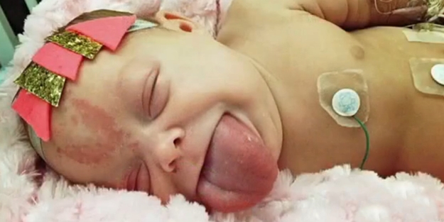 Dilinin büyüklüğü yüzünden az kalsın...