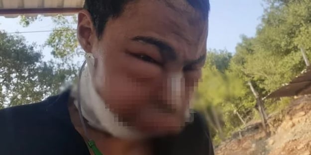 Dilinin altında çıktı çenesini kestiler! Hüseyin'den acı haber geldi