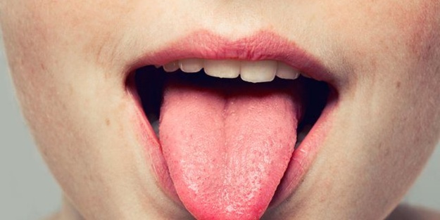 Dilinizin rengi hastalıkları ele veriyor!