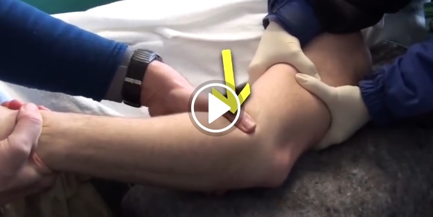 Dirsek çıkığı nasıl tedavi ediliyor?