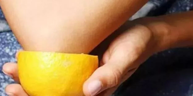 Dirseklere limon sürerseniz...