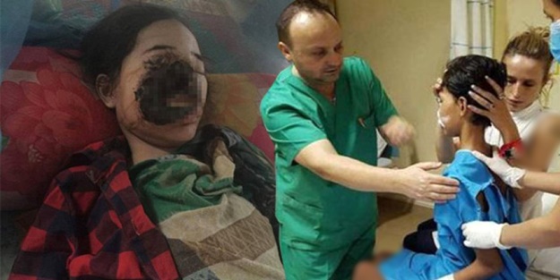 Diş ağrısı için gitti, yüzünü kaybetti!