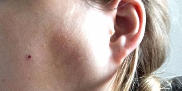 Diş ağrısı zannetti, bakın ne çıktı!