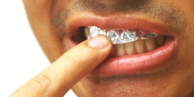 Diş beyazlatmada alüminyum folyoyu denediniz mi?